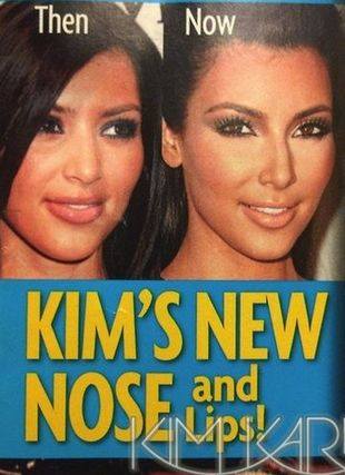 Делала ли Ким Кардашян пластическую операцию?